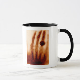 The First X-Ray, 1901, Photograph Mug