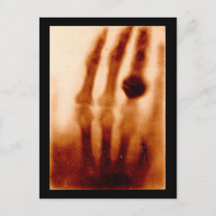 The First X-Ray, 1901, Photograph Postcard