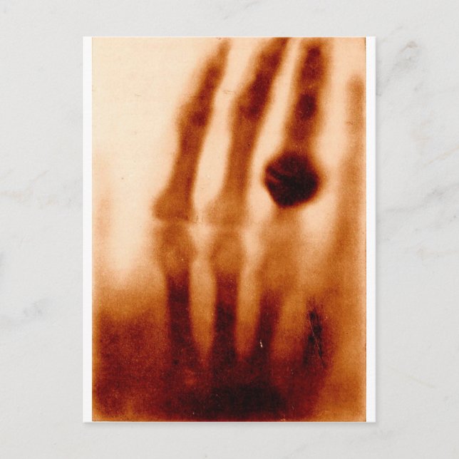 The First X-Ray, 1901, Photograph Postcard (Front)