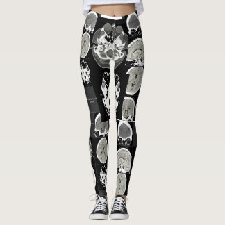 this is what depression looks like_CTFOD Leggings