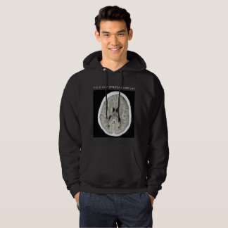 This is what Depression looks like-FullCTScan Hoodie