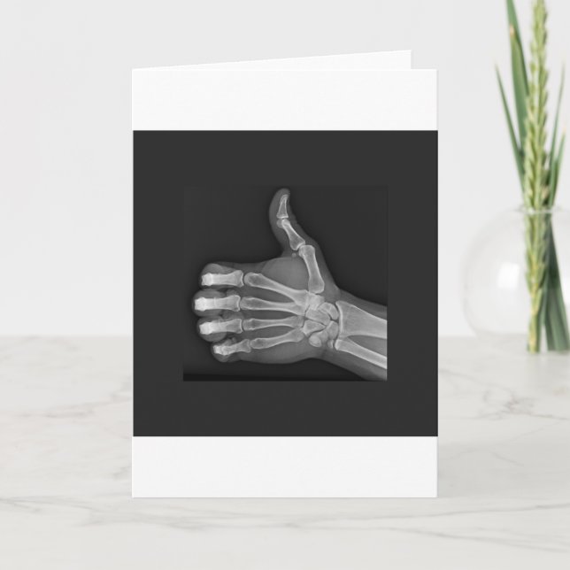 Thumbs up card (Front)