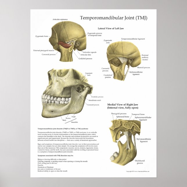 TMJ Joint Syndrome Anatomy Medical Poster (Front)