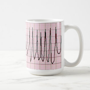 Torsades Coffee Mug
