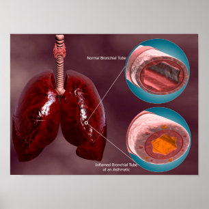 Trachea Cross-Section With Lungs Poster