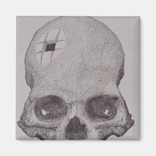 Trepanned Skull Magnet