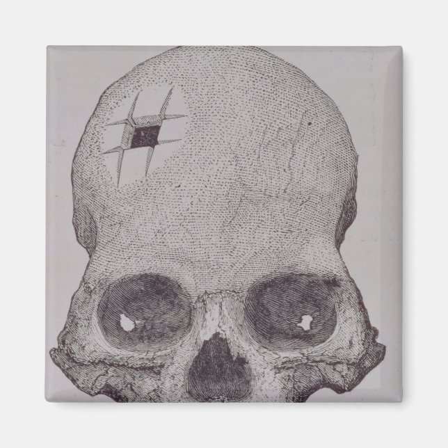 Trepanned Skull Magnet (Front)
