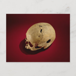 Trepanned Skull Postcard