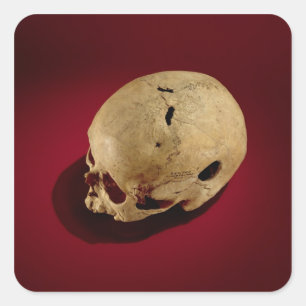 Trepanned Skull Square Sticker