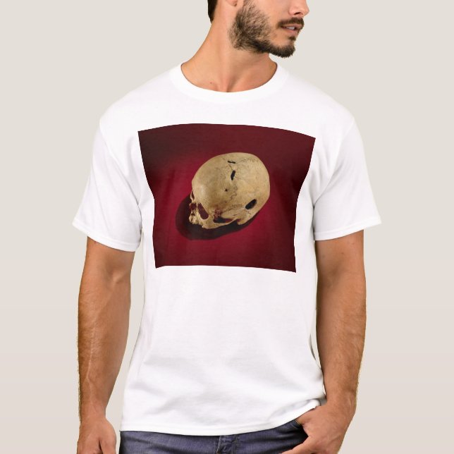 Trepanned Skull T-Shirt (Front)