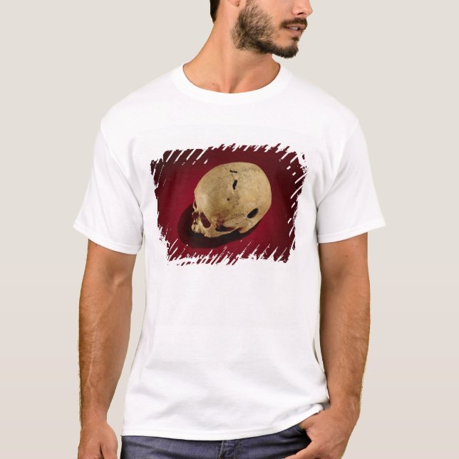 Trepanned Skull T-Shirt (Front)