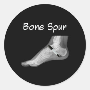 Trump Bone Spur Ink Pen Funny Anti Trump  Classic Round Sticker