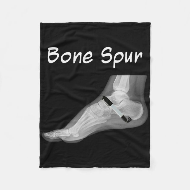 Trump Bone Spur Ink Pen Funny Anti Trump  Fleece Blanket (Front)