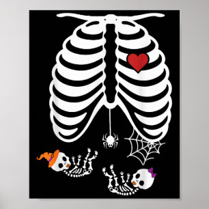 Twins Pregnancy Halloween Pregnancy Announcement P Poster
