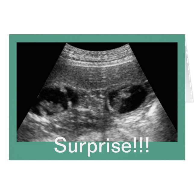 Twins Ultrasound (Front Horizontal)