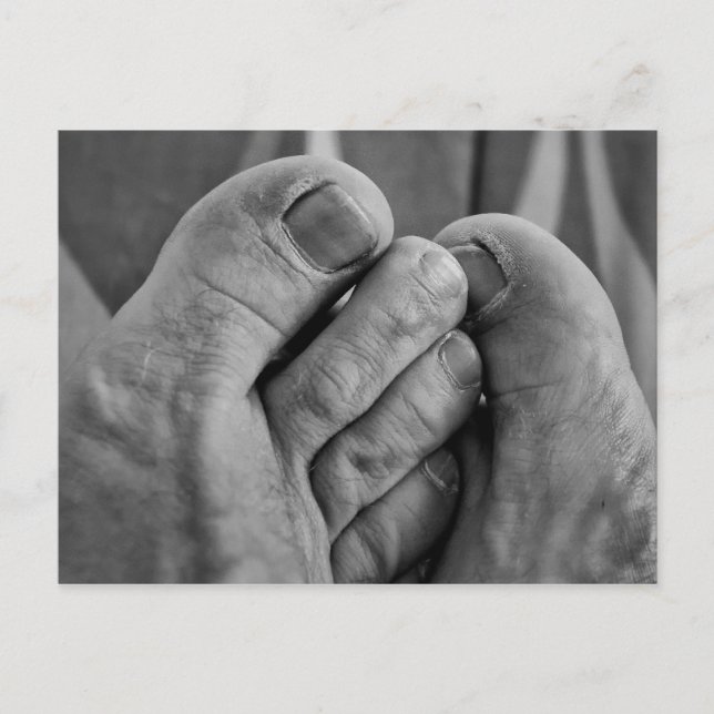 Ugly Feet Postcard (Front)