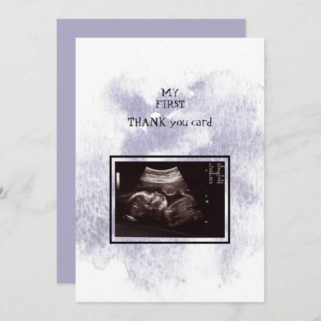 Ultrasound Girl Thank You Baby Point of View (Front/Back)