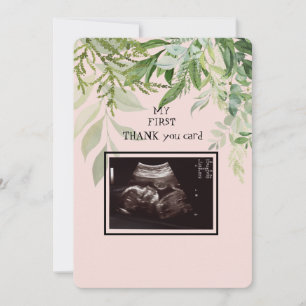 Ultrasound Girl Thank You Baby Point of View Card