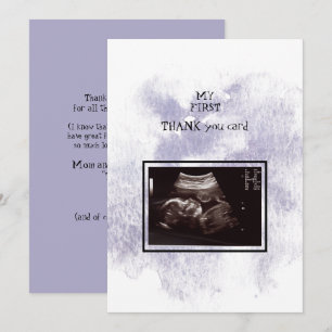 Ultrasound Girl Thank You Baby Point of View Card