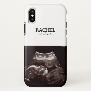 Ultrasound Photo Black and White Monogram iPhone X Case