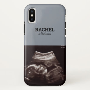 Ultrasound Photo Dusty Blue Monogram iPhone X Case