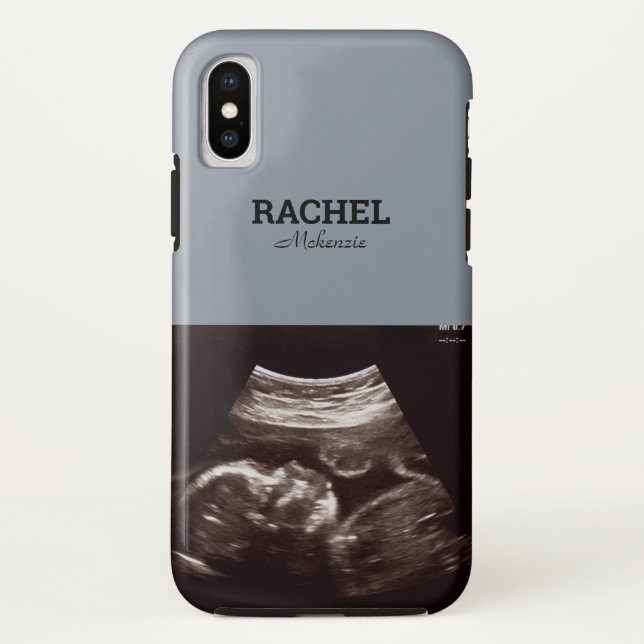 Ultrasound Photo Dusty Blue Monogram Case-Mate iPhone Case (Back)