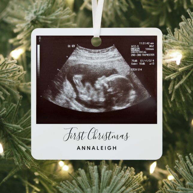 Ultrasound Photo First Christmas Holiday Metal Tree Decoration (Insitu)