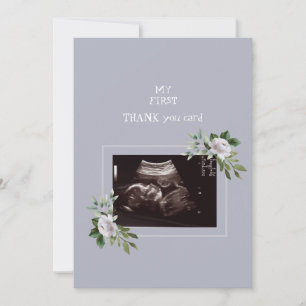 Ultrasound Photo Girl Thank You Baby Point of View Card