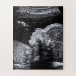 Ultrasound Photo Jigsaw Puzzle