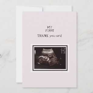 Ultrasound Photo Pink Thank You Baby Card