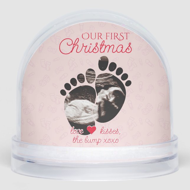 Ultrasound Pregnancy Announcement 1st Christmas Snowglobe (Front)