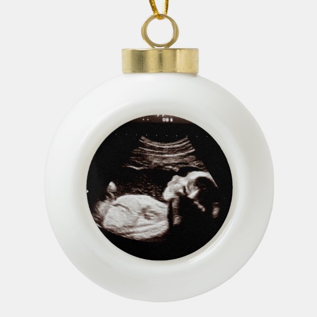 Ultrasound Pregnancy Announcement  Ceramic Ball Christmas Ornament (Front)
