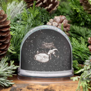 Ultrasound Snow Globe