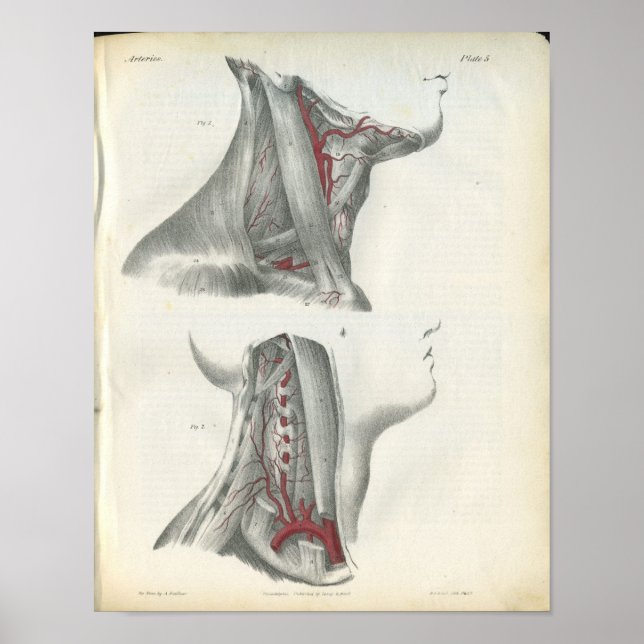 Vertebral Arteries Neck Anatomy Print (Front)