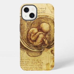 View of a Foetus in the Womb,Ob-Gyn Medical iPhone Case