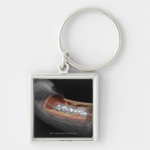 View of an angioplaty balloon in an artery key ring