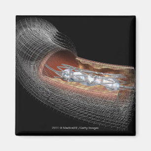 View of an angioplaty balloon in an artery magnet