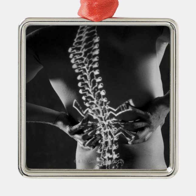 View of spinal chord metal tree decoration (Front)
