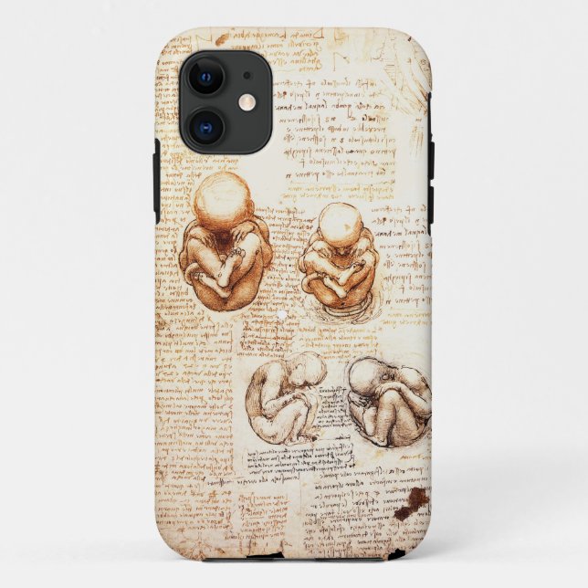 Views of a Foetus in the Womb,Ob-Gyn Medical Case-Mate iPhone Case (Back)