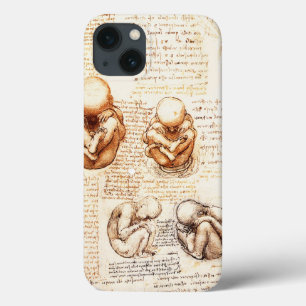 Views of a Foetus in the Womb,Ob-Gyn Medical iPhone 13 Case
