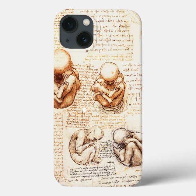 Views of a Foetus in the Womb,Ob-Gyn Medical Case-Mate iPhone Case (Back)