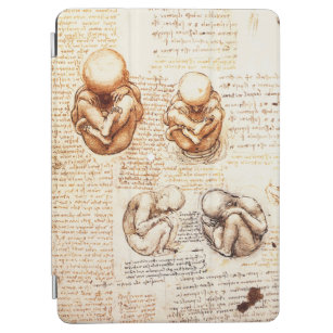 Views of a Foetus in the Womb,Ob-Gyn Medical iPad Air Cover