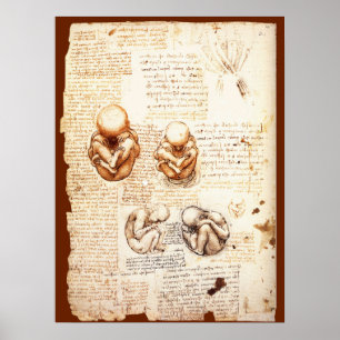 Views of a Foetus in the Womb,Ob-Gyn Medical Poster