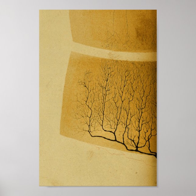 Vintage 1886 Central Nervous System Nerves Poster (Front)