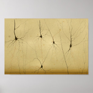 Vintage 1886 Central Nervous System Nerves Poster