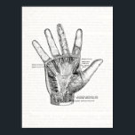Vintage Anatomy Art The Palm of the Hand Poster<br><div class="desc">This black and white anatomy illustration features muscles of the palm of the hand.</div>