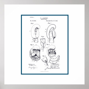 Vintage Boxing Glove Patent Poster
