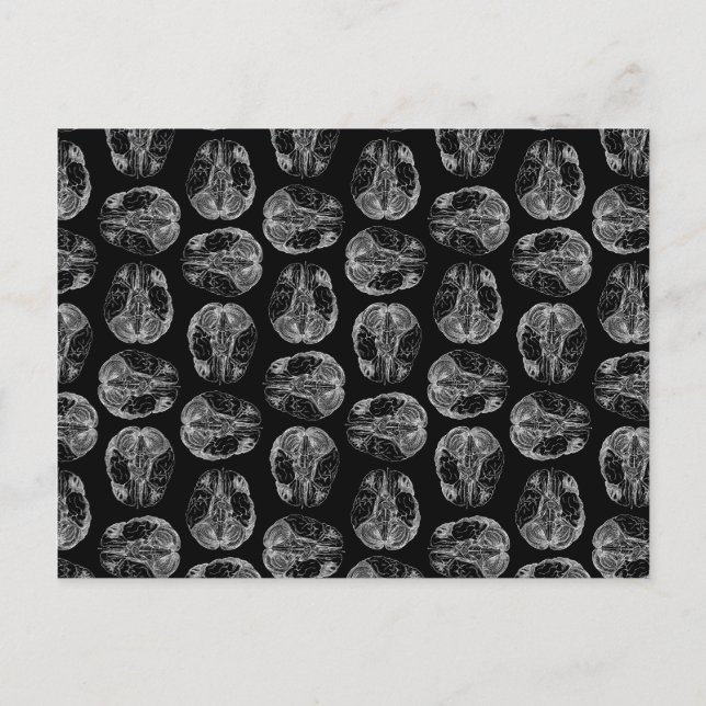 Vintage Brain Diagram Print Pattern Brains Black Postcard (Front)