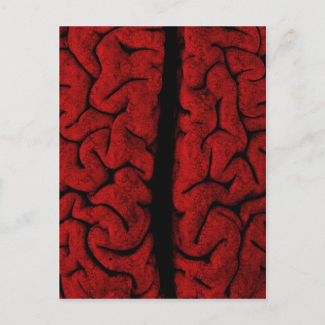 Vintage Brain Postcard (Front)