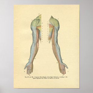 Vintage Frohse Arm Nerve Innervation Print